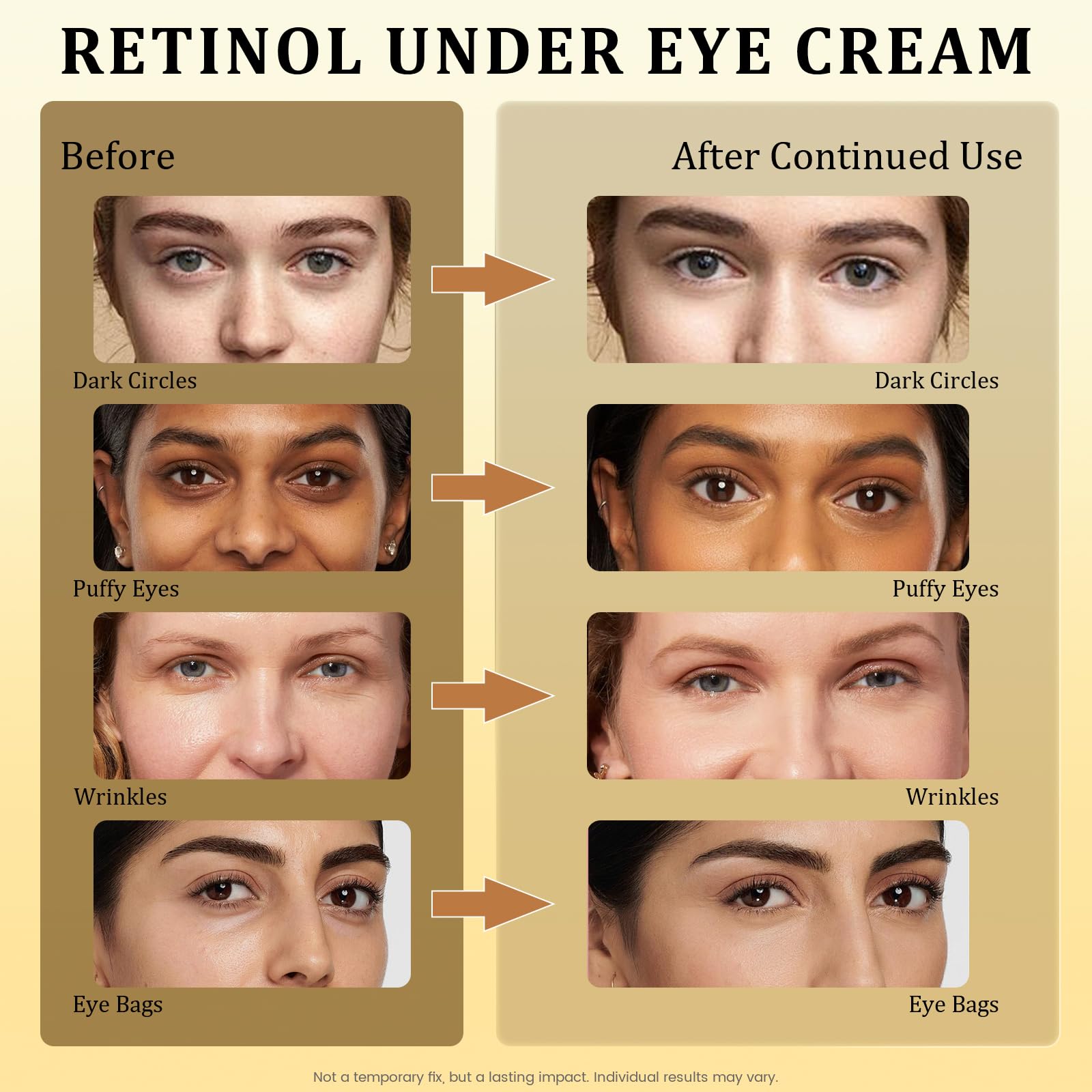 Retinol Eye Cream brightening look highlighting brighter under-eye appearance without heaviness