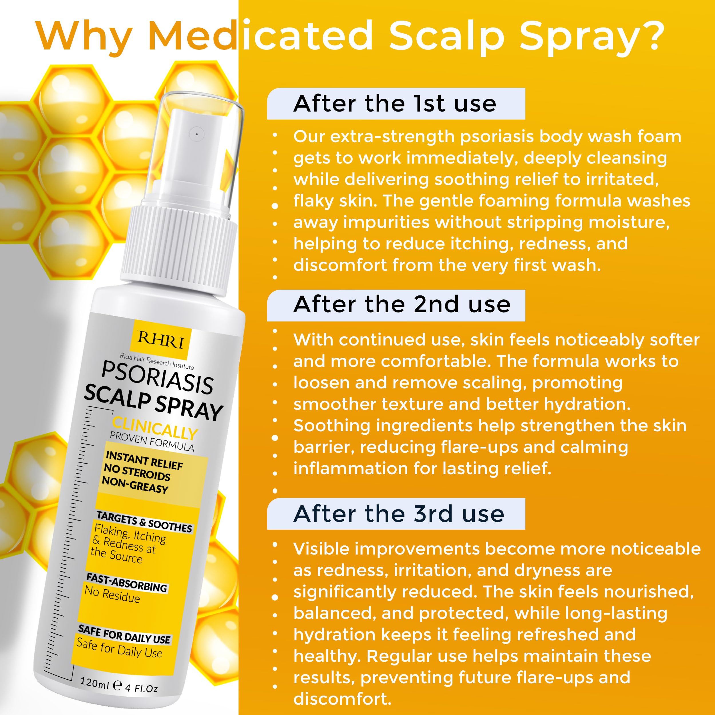 Rida Hair Psoriasis Scalp Spray helps manage dryness with a cooling, comforting sensation.