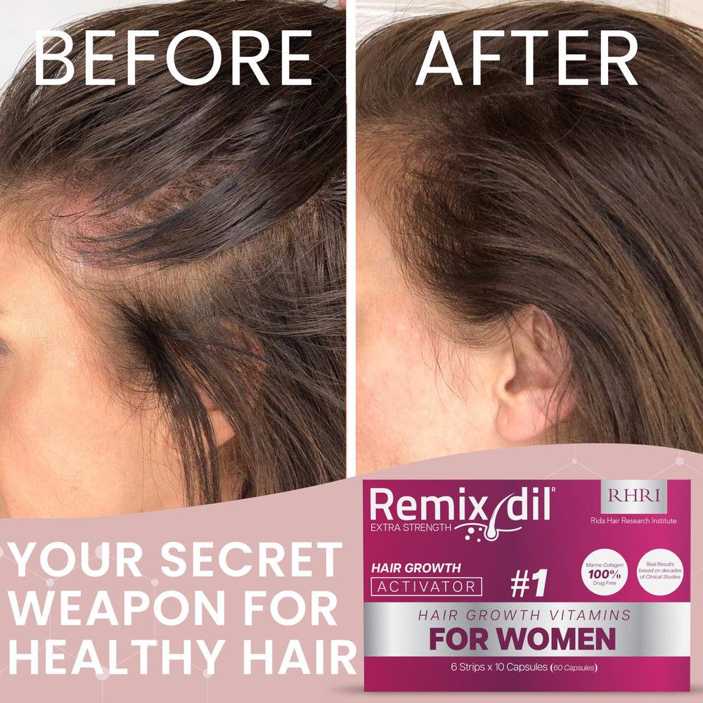 Rida Hair Growth Vitamins package shot highlighting complete hair care solution benefits.