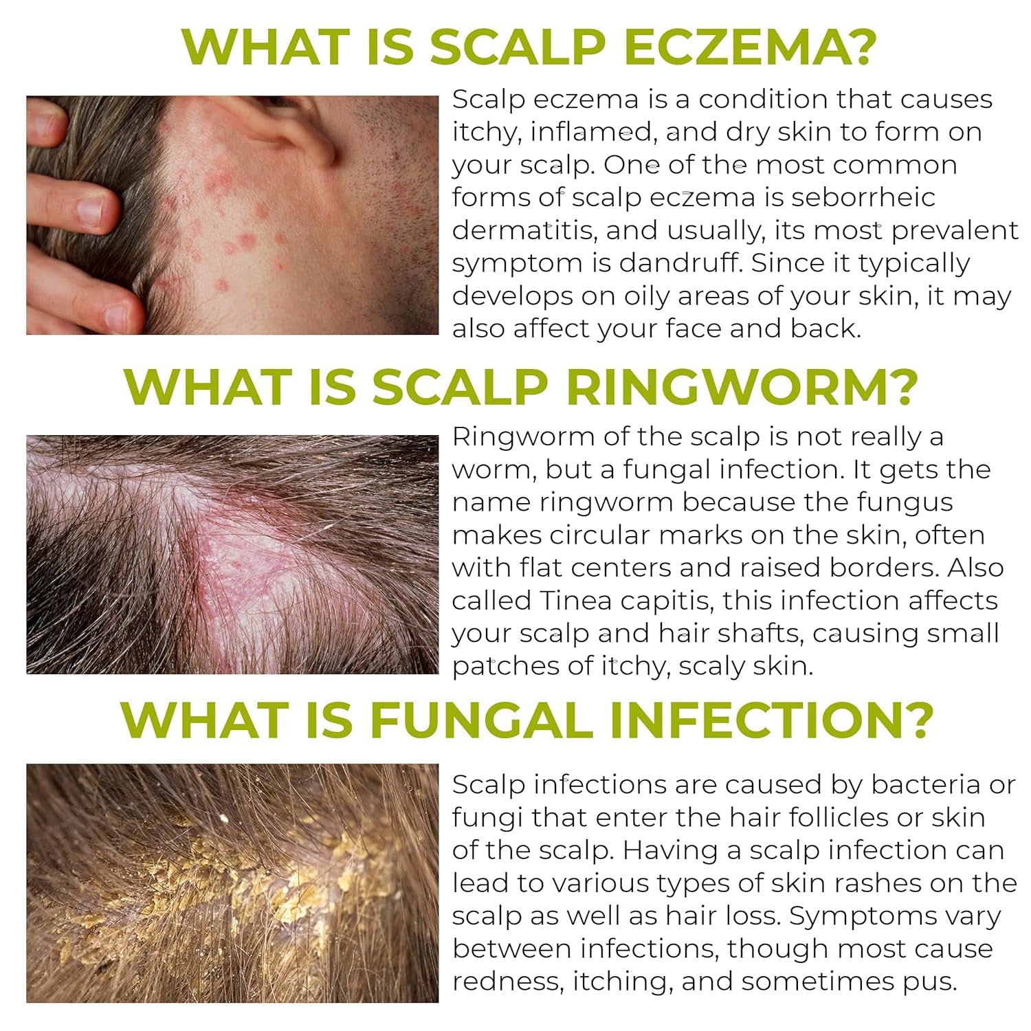 Rida Hair Folliculitis Shampoo closeup of herbal ingredients highlighting natural care