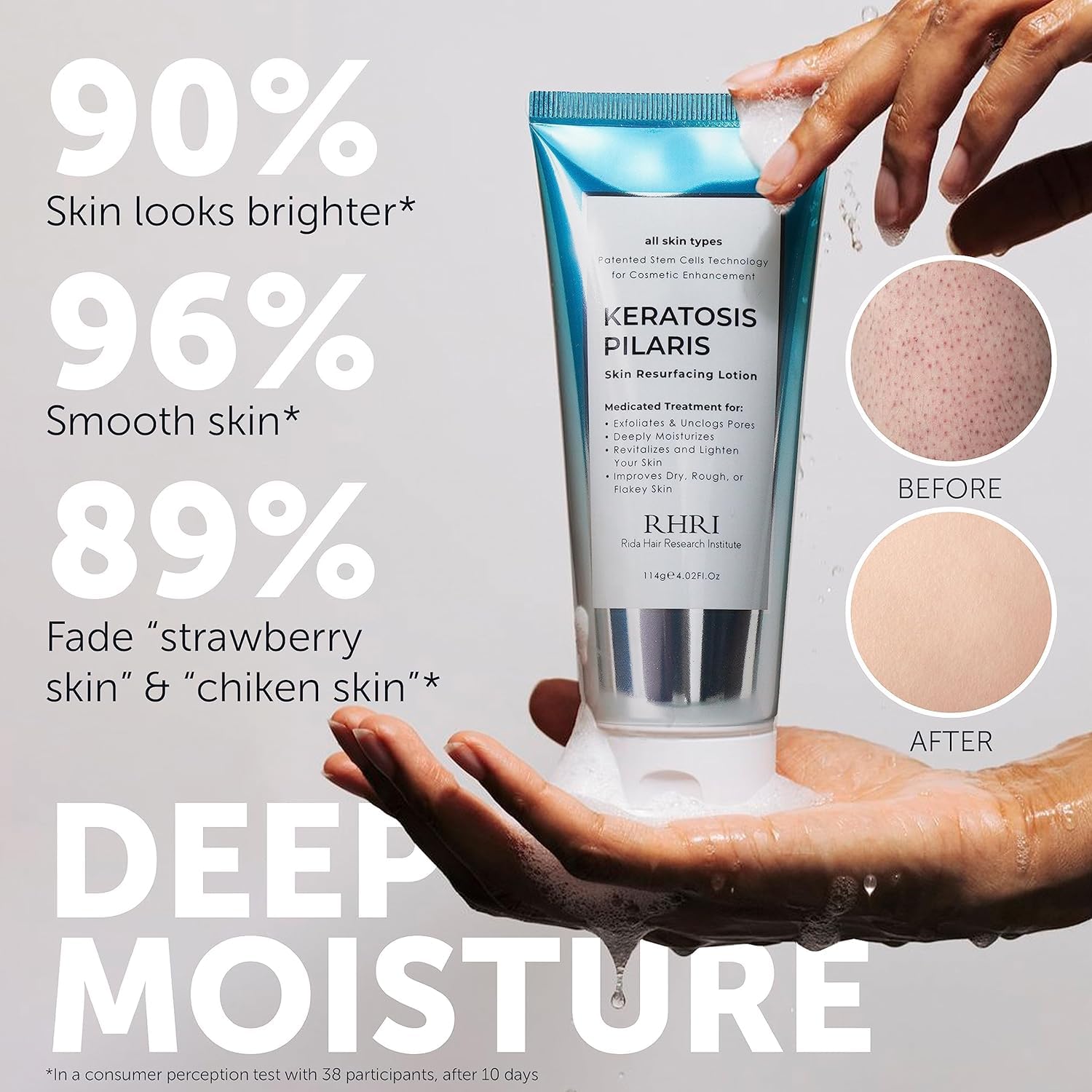 Rida Hair Research Institute KP Bump Eraser texture on skin demonstrates gentle exfoliation benefits.