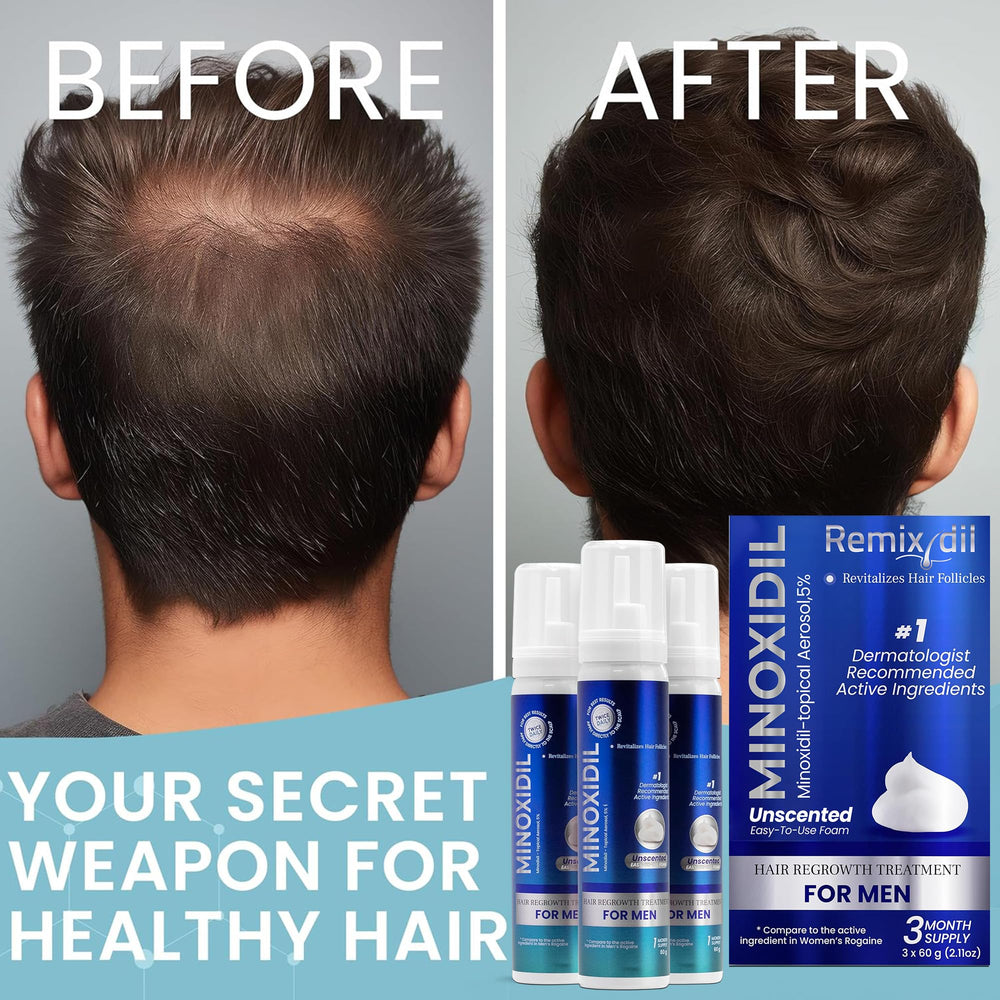 Rida Remixidil non greasy foam dries quickly without residue.