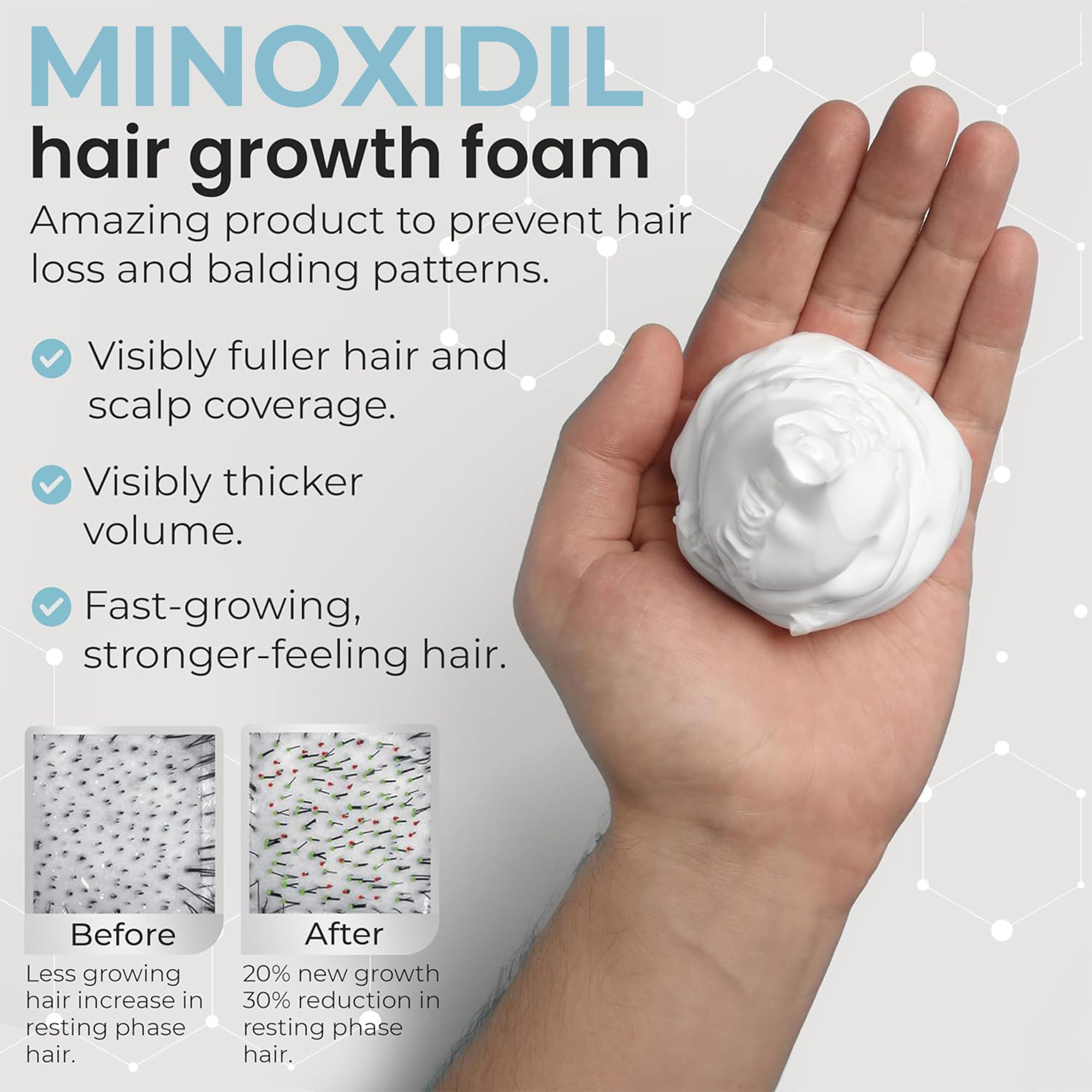 Rida Remixidil packaging highlights three month supply and dermatologist backed formula.