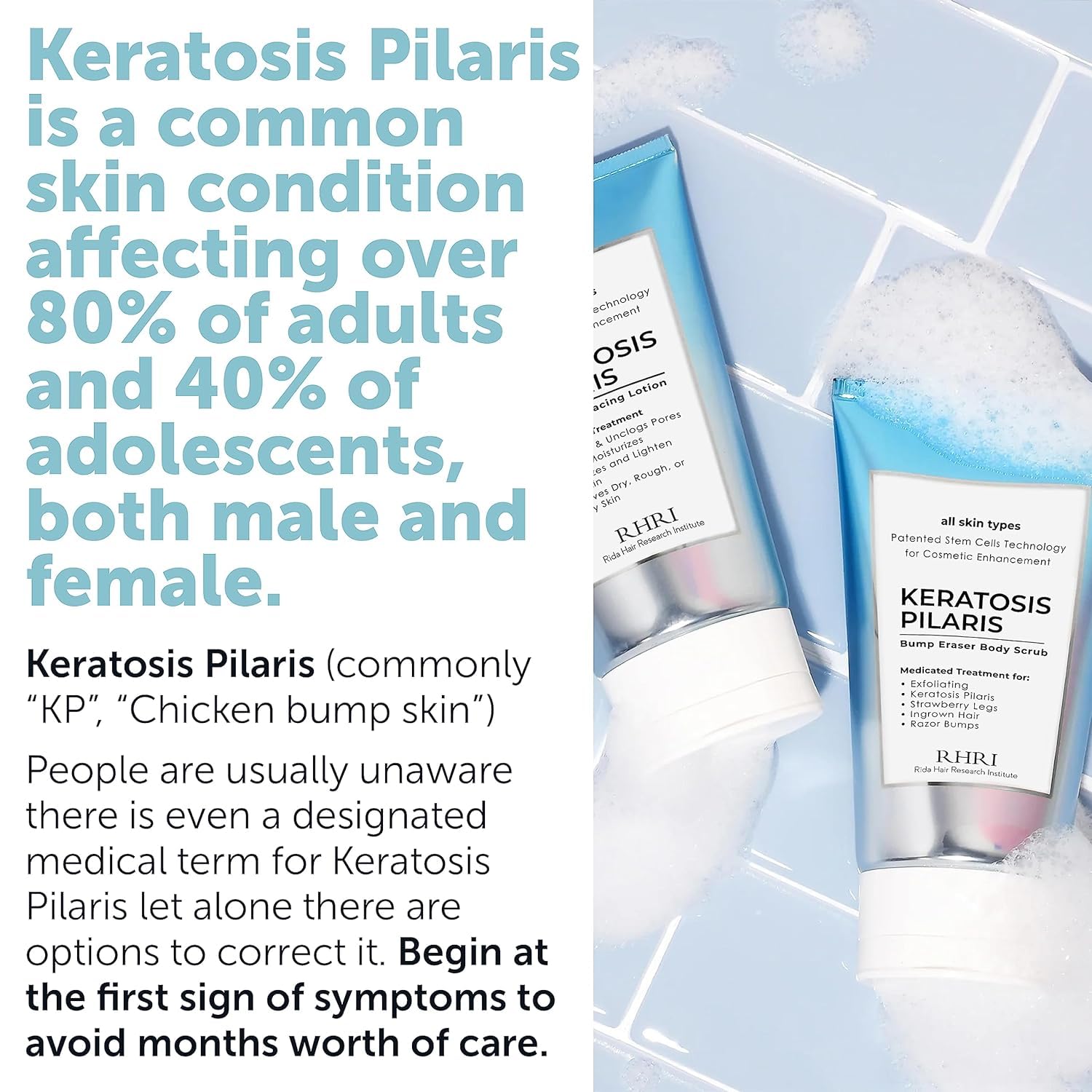 Rida KP Bump Eraser Exfoliating Scrub close-up shows gentle glycolic exfoliation.