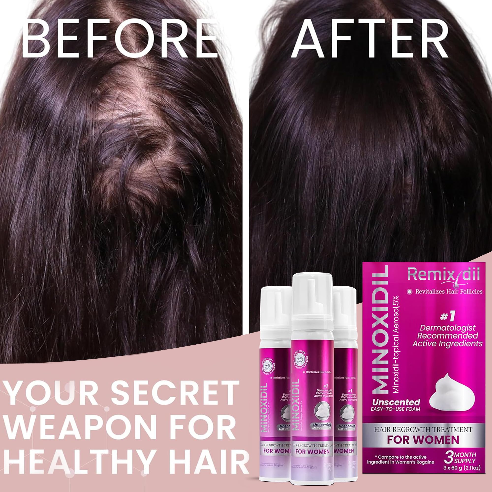 Rida Hair minoxidil foam 3-month supply suitable for steady regrowth routines.