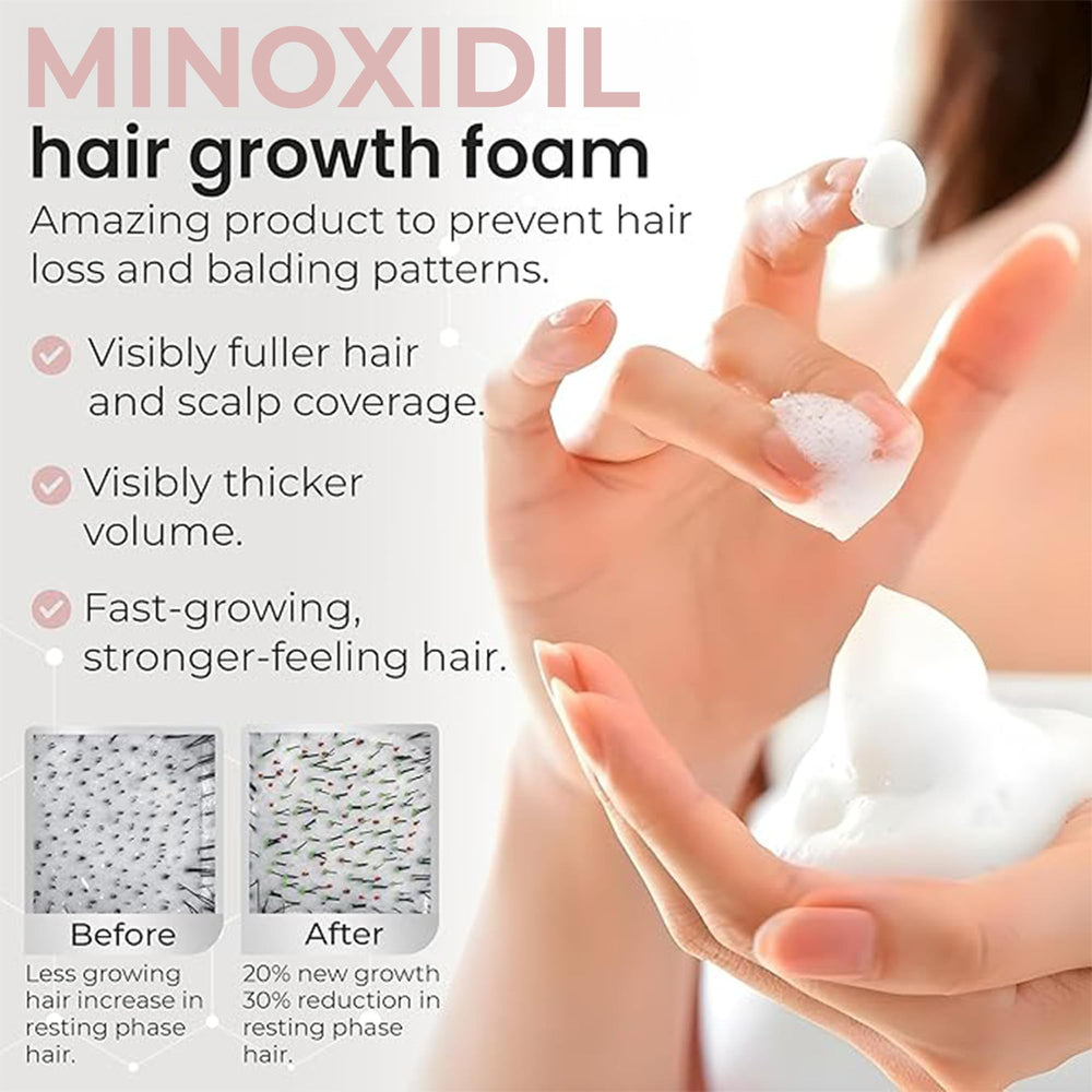 Rida Hair minoxidil foam shown with dermatologist-recommended branding for women.