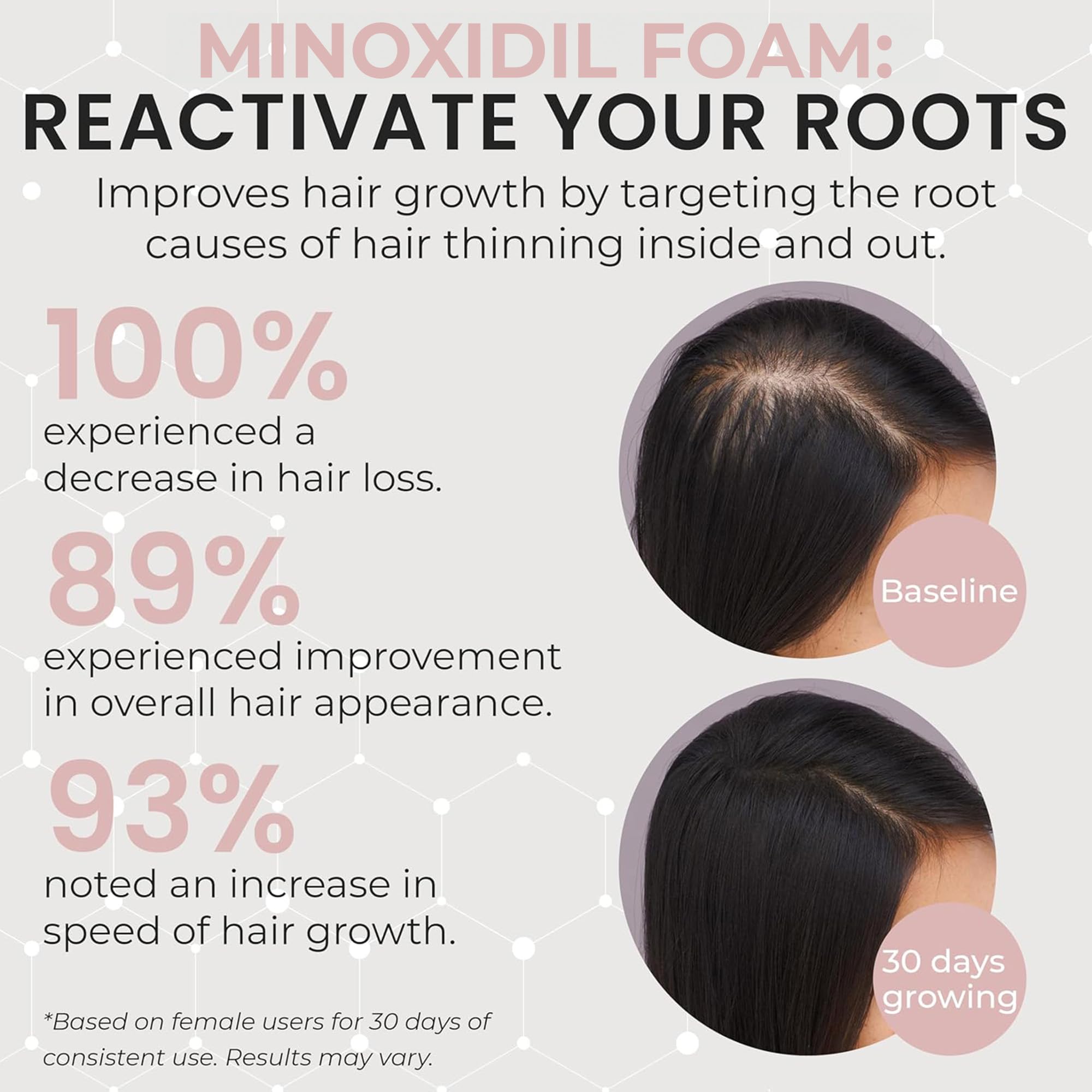 Rida Hair minoxidil foam on scalp is unscented and gentle for sensitive scalps.