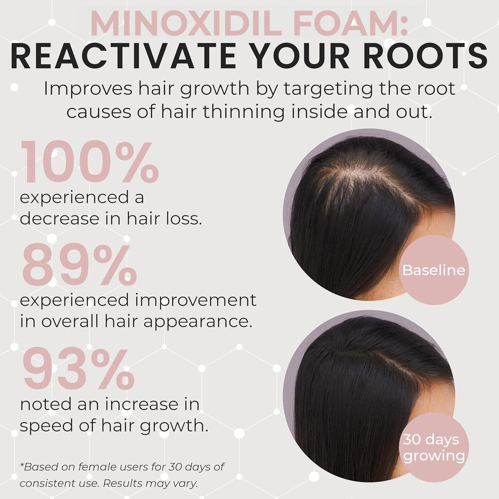 Rida Hair minoxidil foam on scalp is unscented and gentle for sensitive scalps.