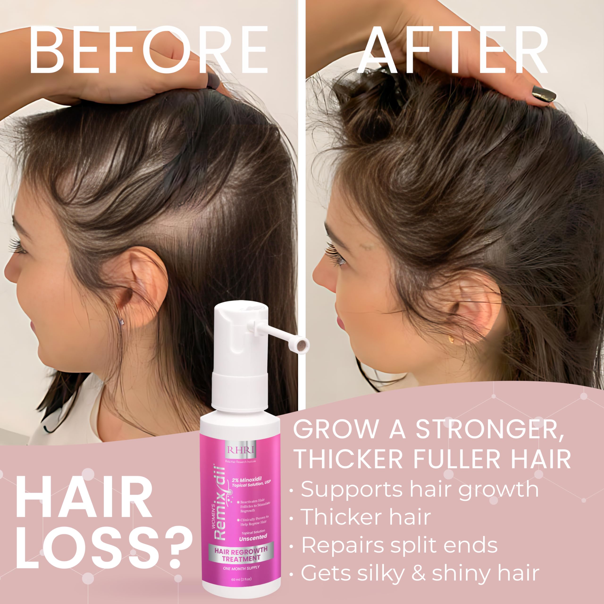 Rida Hair Research Institute 60ml packaging image for at-home regrowth.