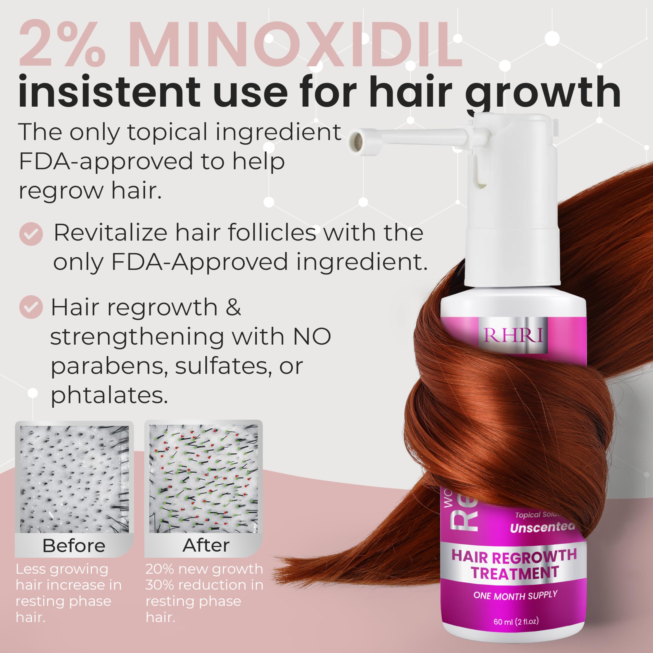 Rida Hair Research Institute scalp thinning area visual highlighting potential coverage.
