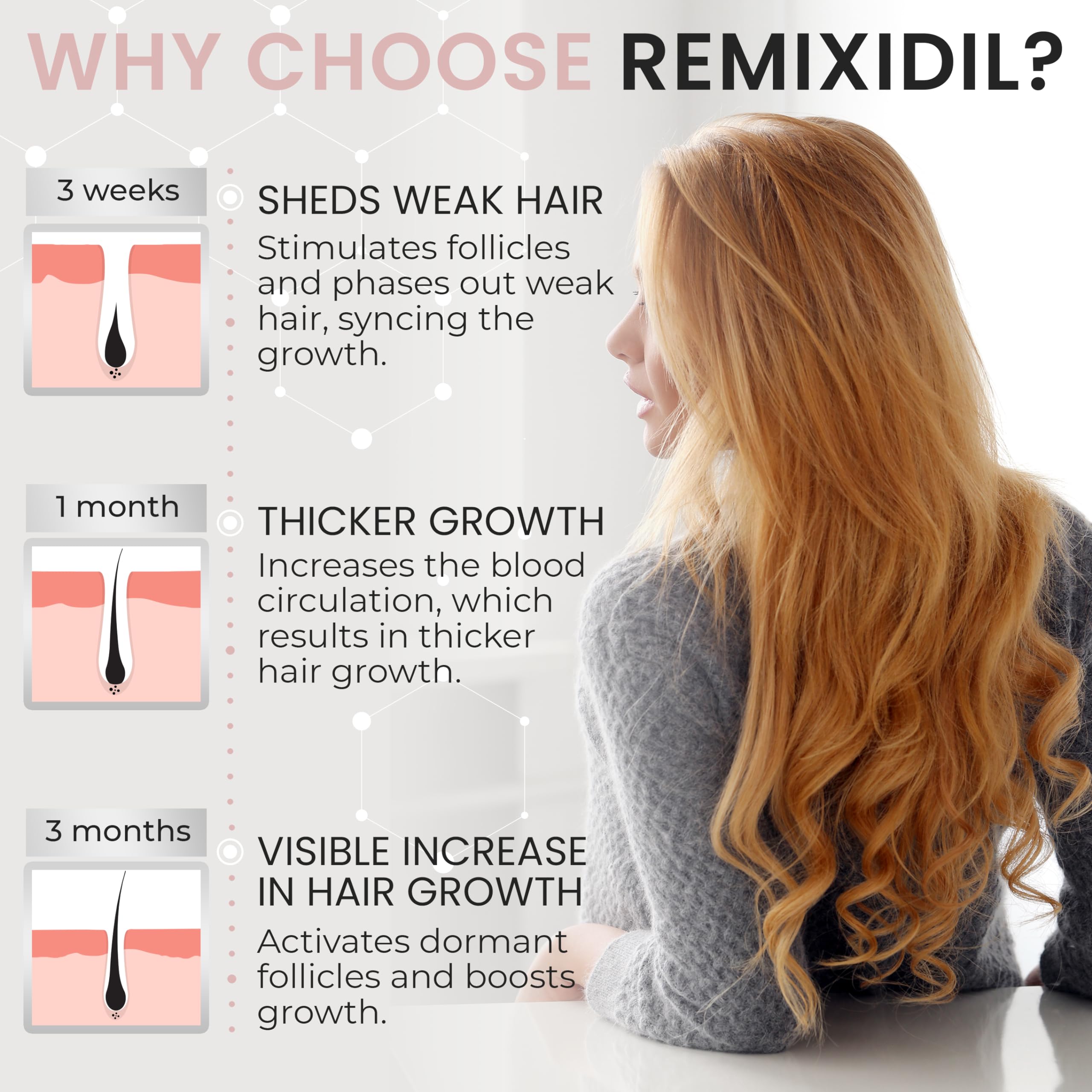 Rida Hair Research Institute minoxidil women hair growth science illustration showing follicles.