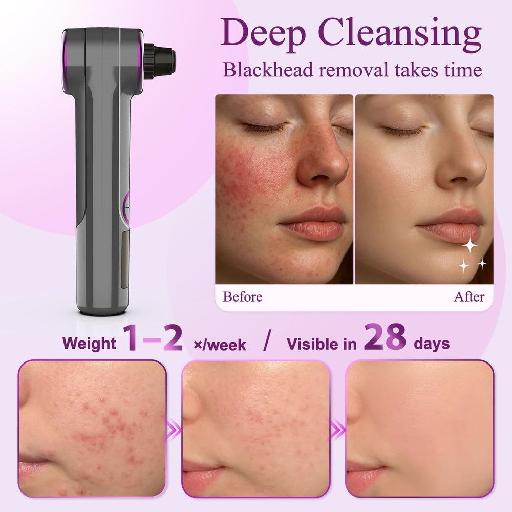 Rinycwa usb-rechargeable-pore-vacuum convenient home or travel skincare.