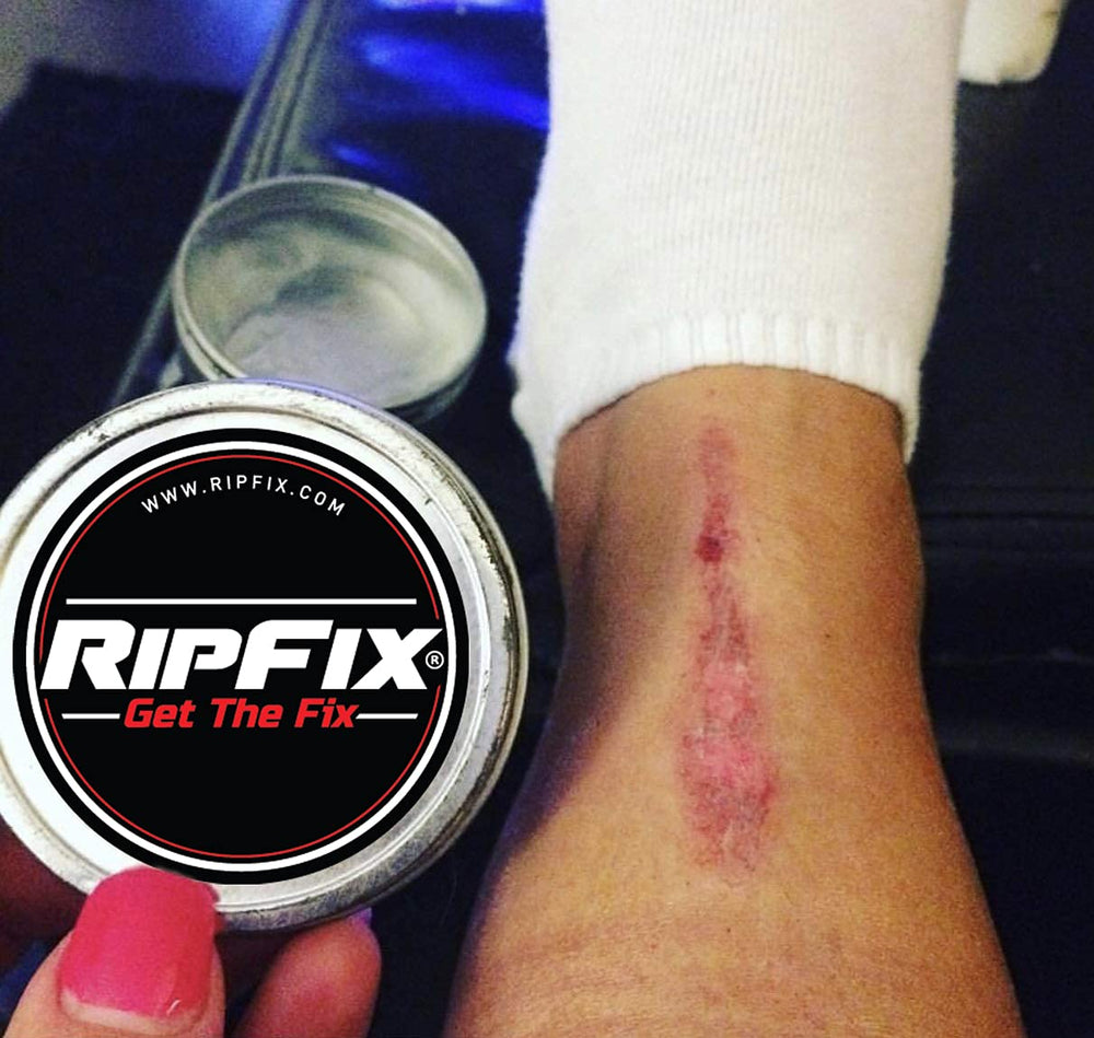 RipFix balm applied to dry hands during training, suggesting on-the-spot relief.