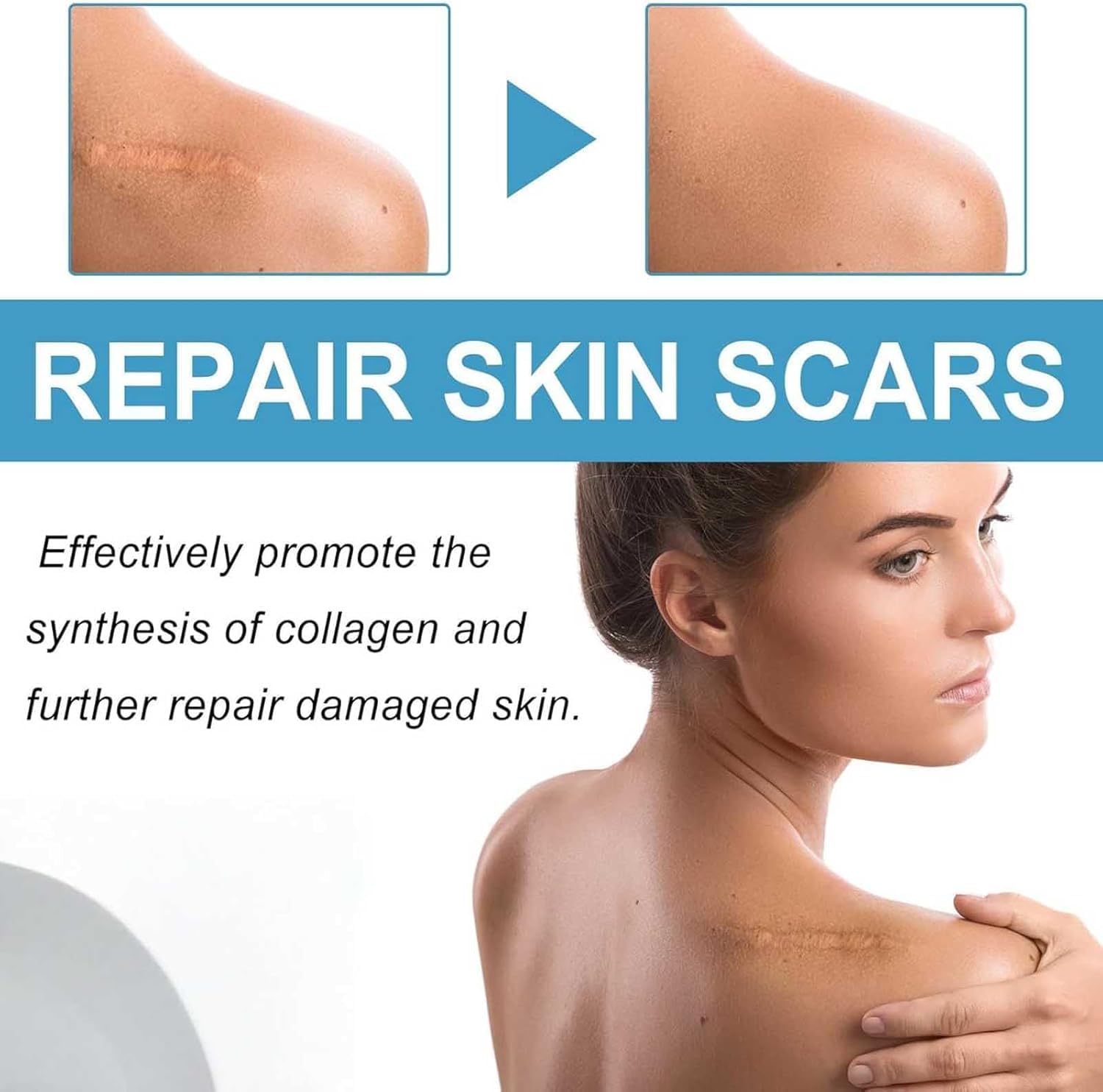RIWYDMA Vetra Scar Stick on skin demonstrating quick fragrance-free use