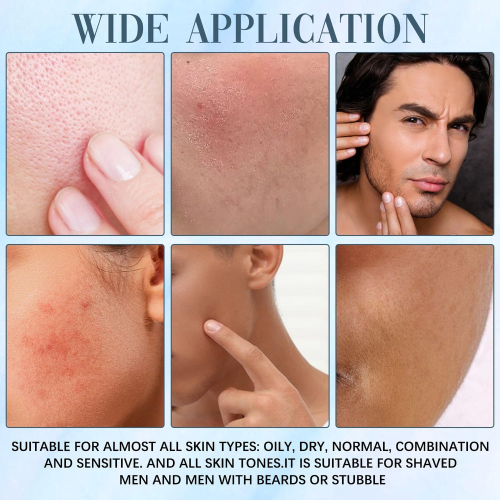 Rliolouo Acne Killer daily care pack displayed for routine integration.