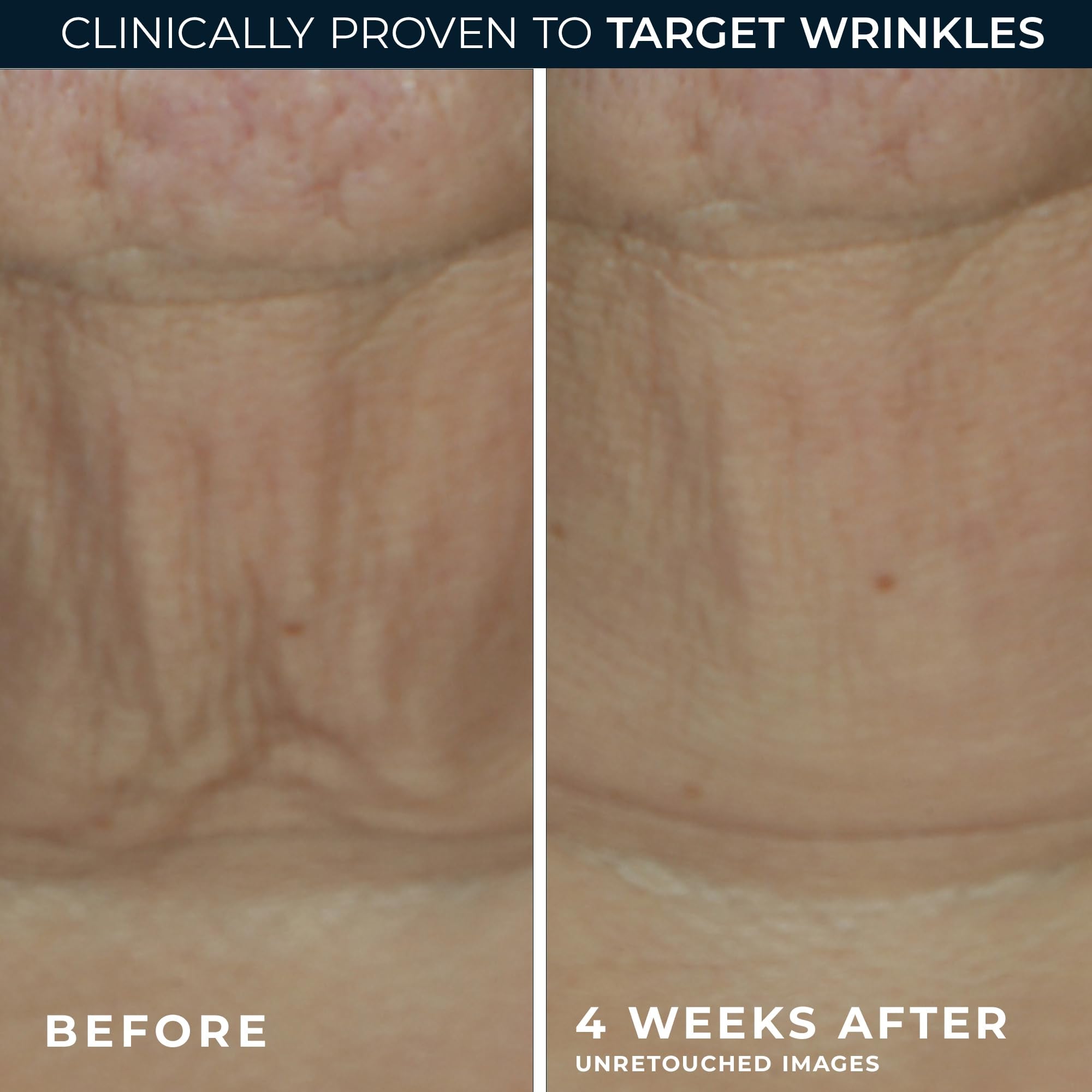 Model applying RoC firming stick along jawline to lift and refine contours