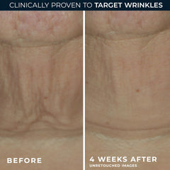 Model applying RoC firming stick along jawline to lift and refine contours