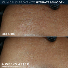 RoC Retinol Correxion Max hyaluronic acid graphic signals deep hydration benefits
