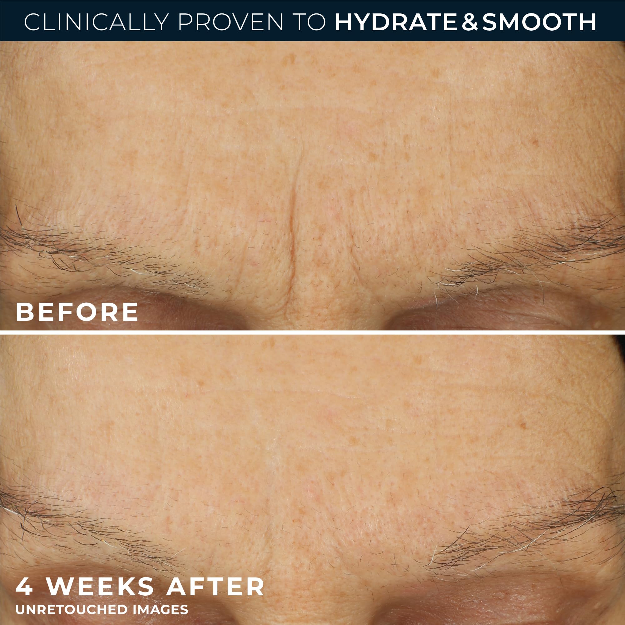 RoC Retinol Correxion Max Hydration oil-free formula helps prevent pore clogging