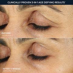 RoC under-eye cream before and after comparison showing visible improvement
