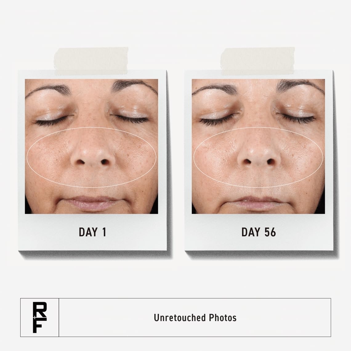 Rodan + Fields Active Hydration Serum hyaluronic acid close-up highlighting moisture magnets