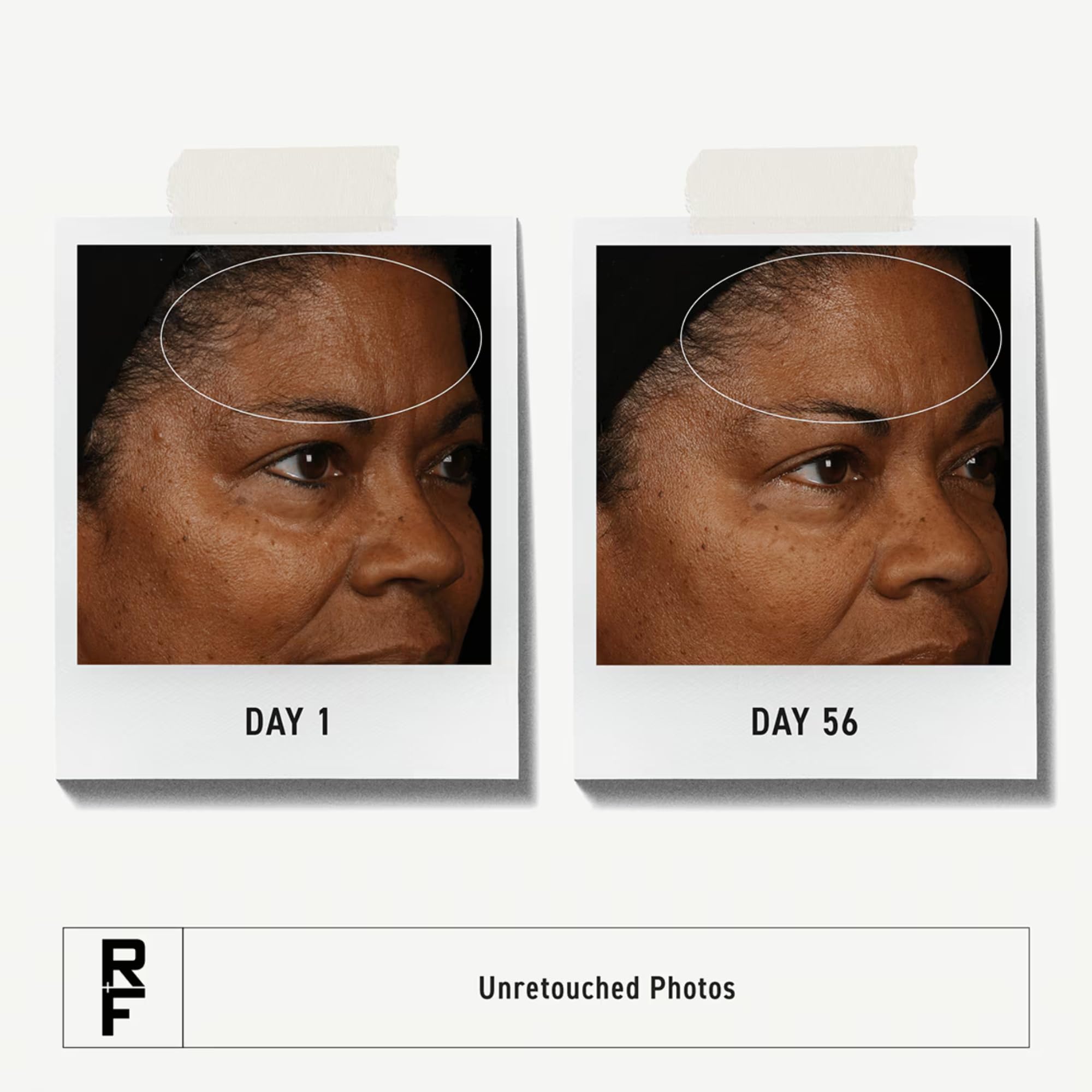 Rodan + Fields Reddefine Pore Toner application highlights pore tightening and even tone.