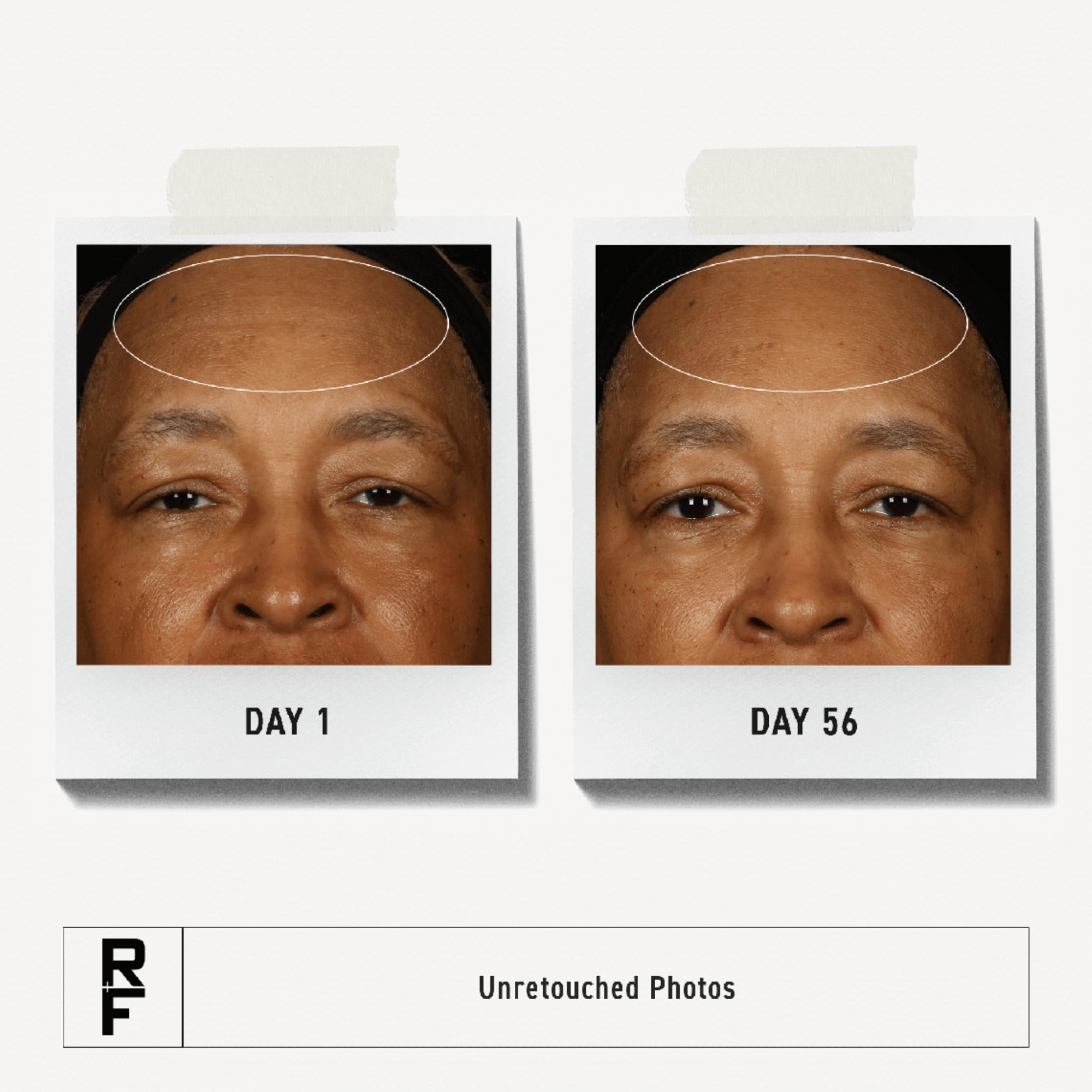 RODAN + FIELDS redefine triple defense cream texture closeup shows smooth, hydrating cream for dry skin.