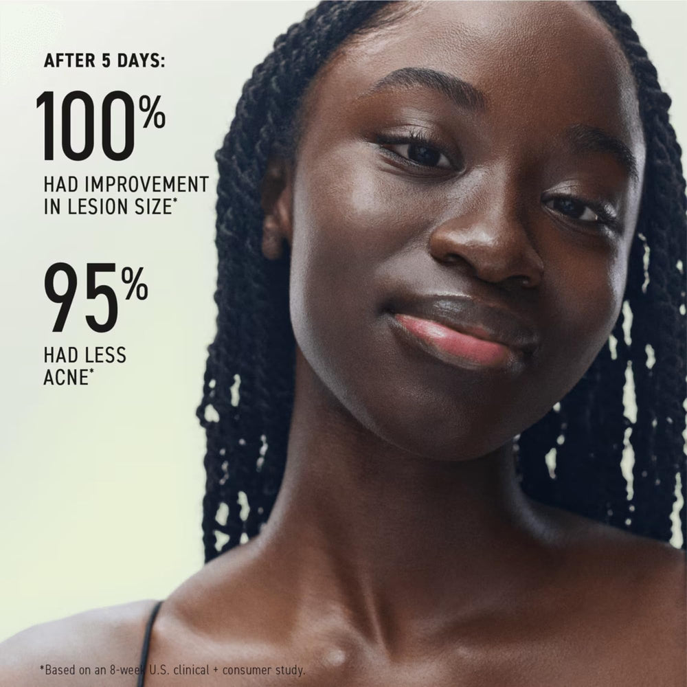 Rodan + Fields Spotless Regimen pore-cleanse closeup showcases refreshing cleanse and oil balance.