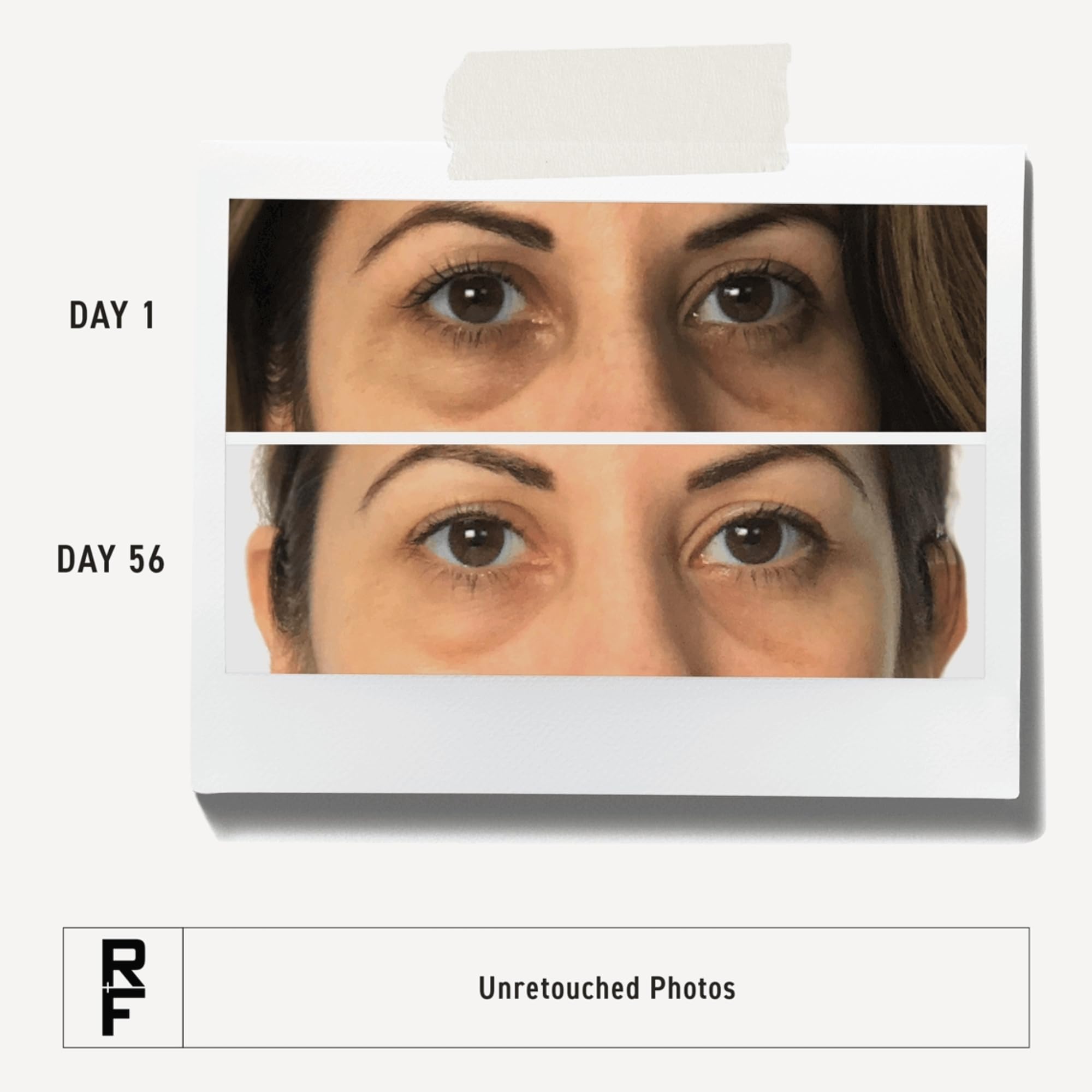 RODAN + FIELDS Under-eye cream smoothing effect demonstrated on delicate skin.