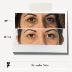 RODAN + FIELDS Under-eye cream smoothing effect demonstrated on delicate skin.