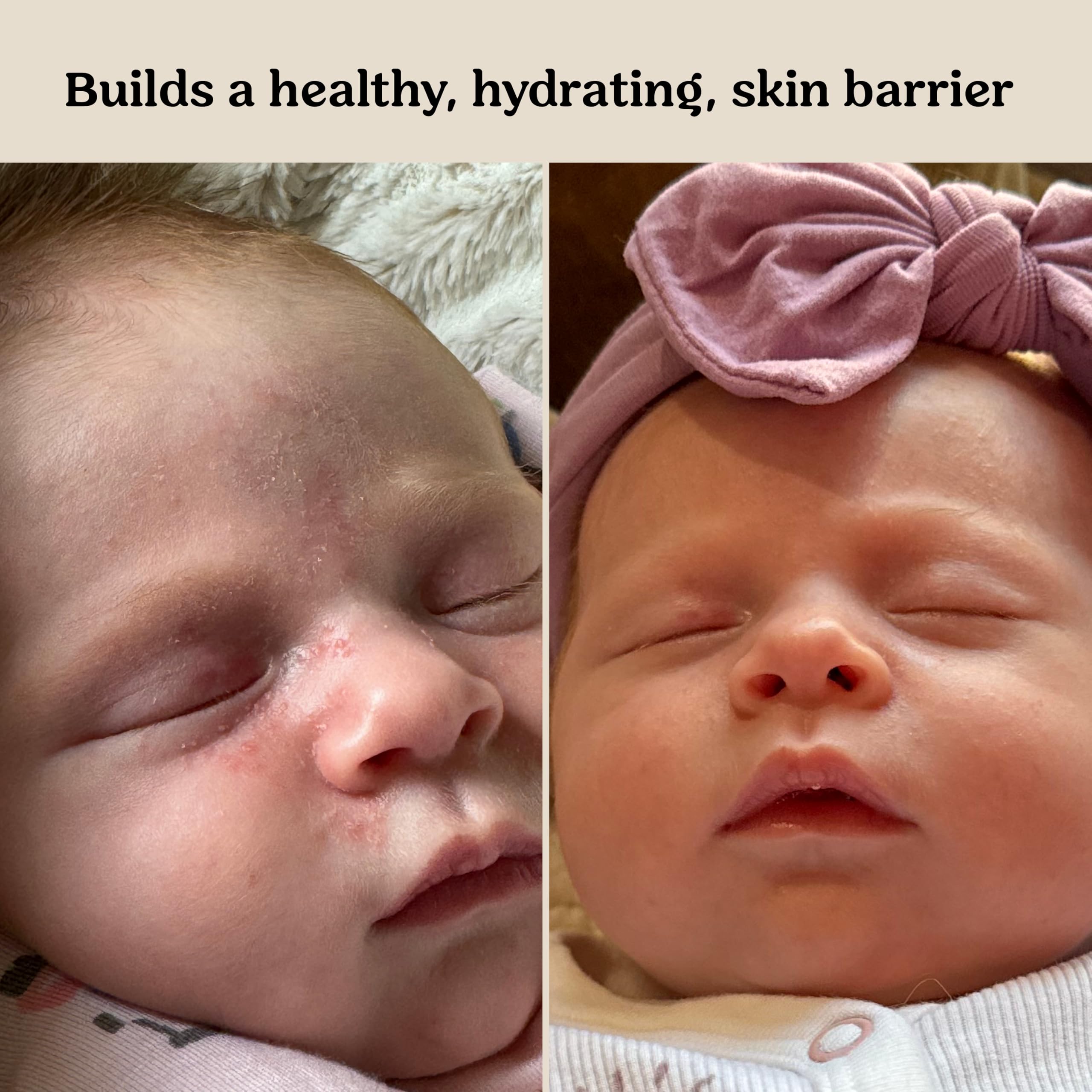 Roe Wellness Lactococcus Ferment Lysate ingredient highlight for barrier support.