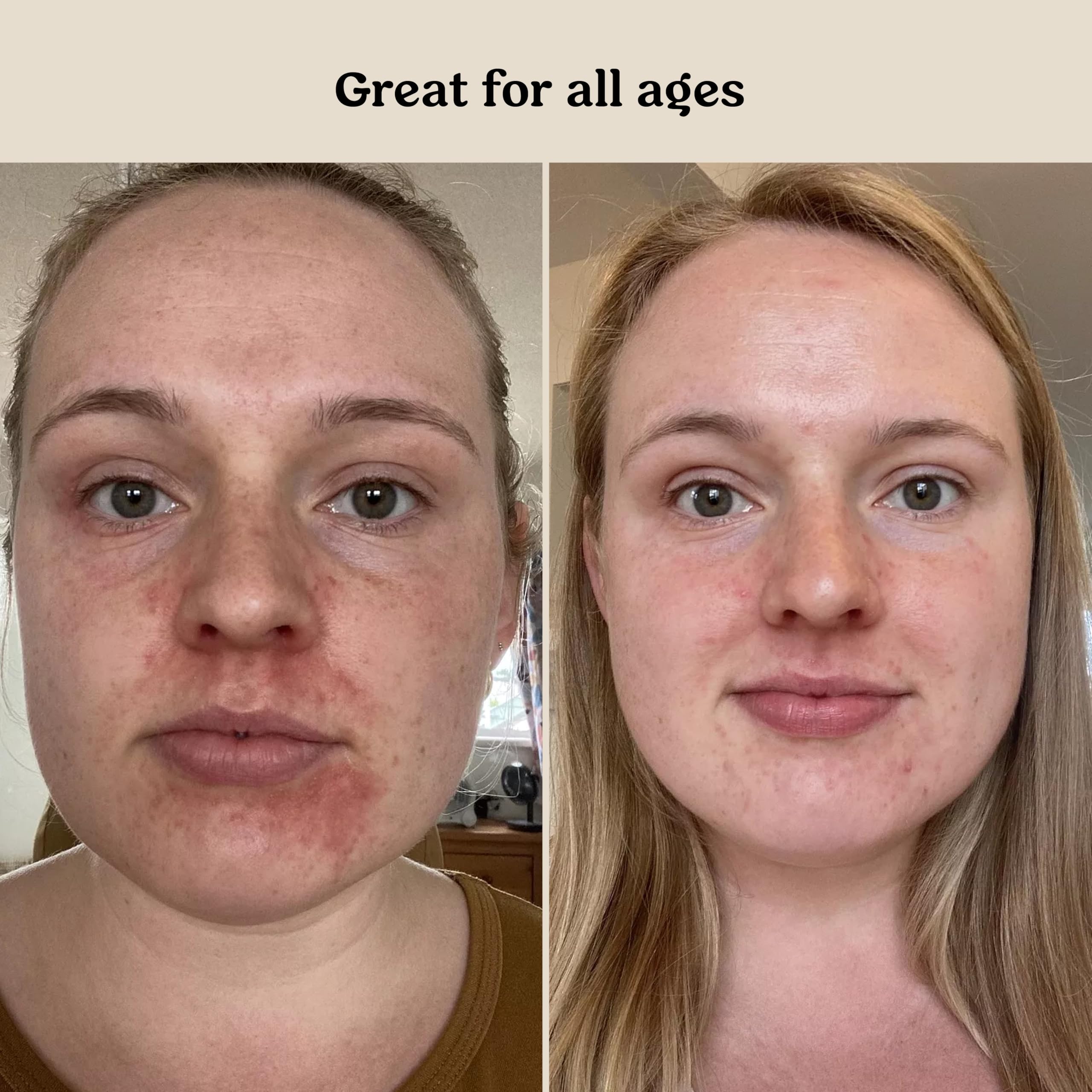 Roe Wellness morning routine with baby serum for daily hydration.