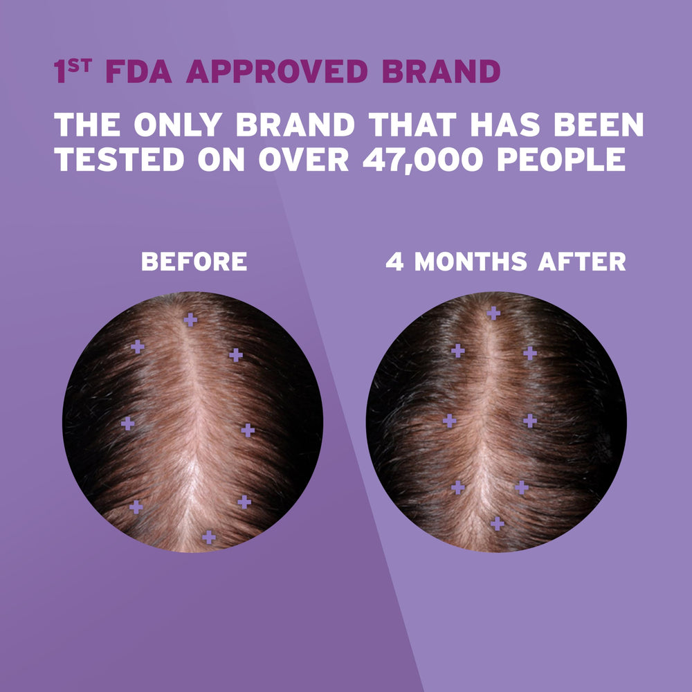 Rogaine close-up of dropper dispensing solution to scalp for precise application