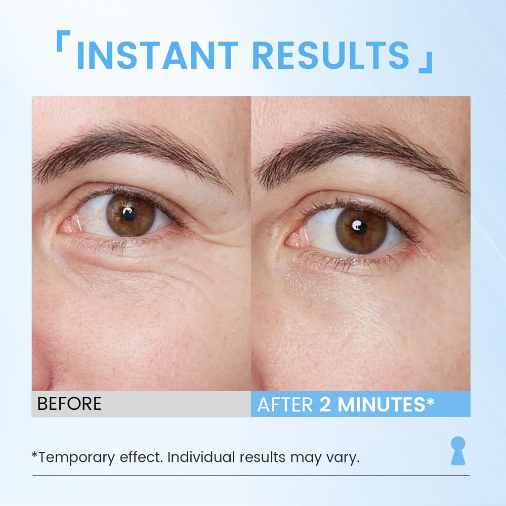 RONKIE Instant Eye Lift under-eye application demonstrates smoothing effect before meetings.
