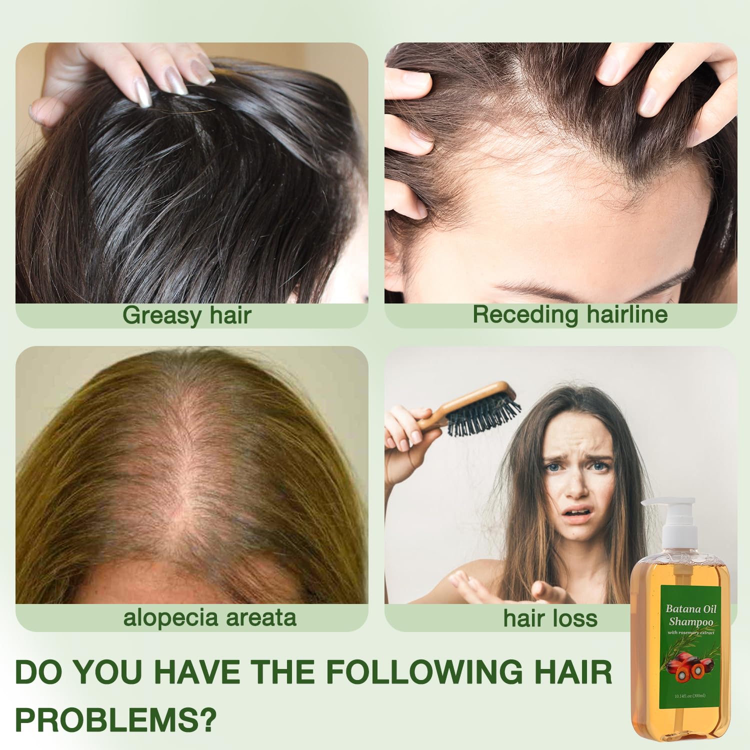 rooroopet rosemary oil dropper for revitalized scalp support.