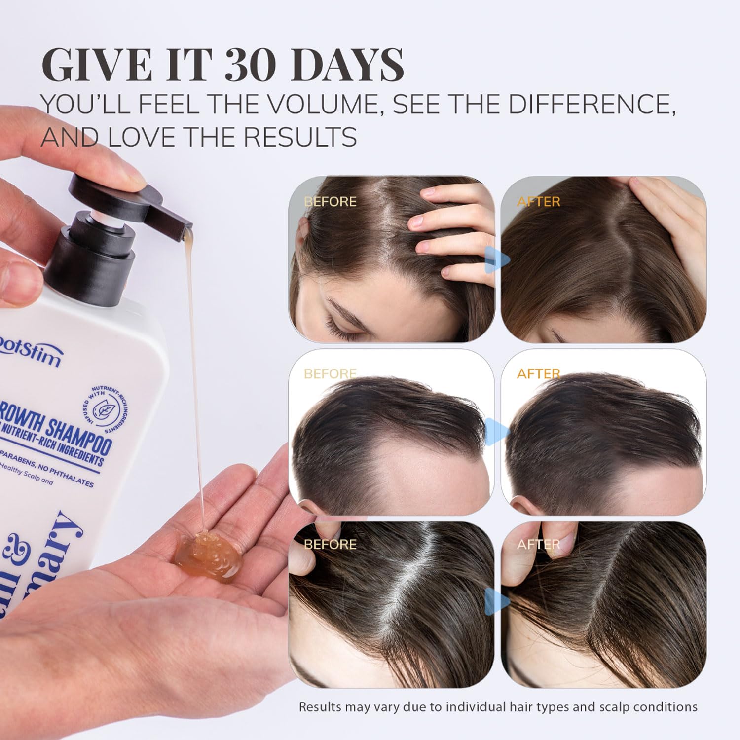 RootStim Biotin-Rosemary Shampoo hands rubbing—gentle wash suitable for sensitive scalps.