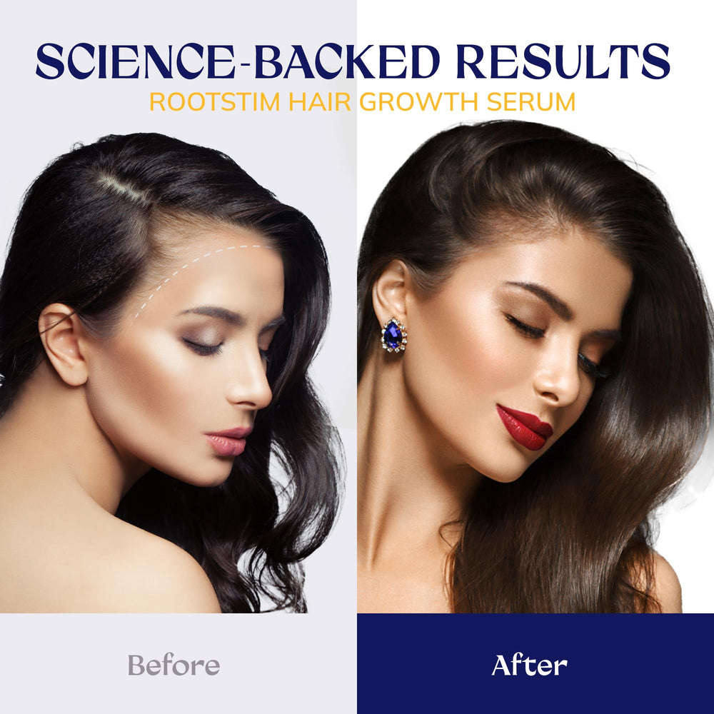 RootStim Scalp soothing with horse chestnut signals calming relief for scalp.