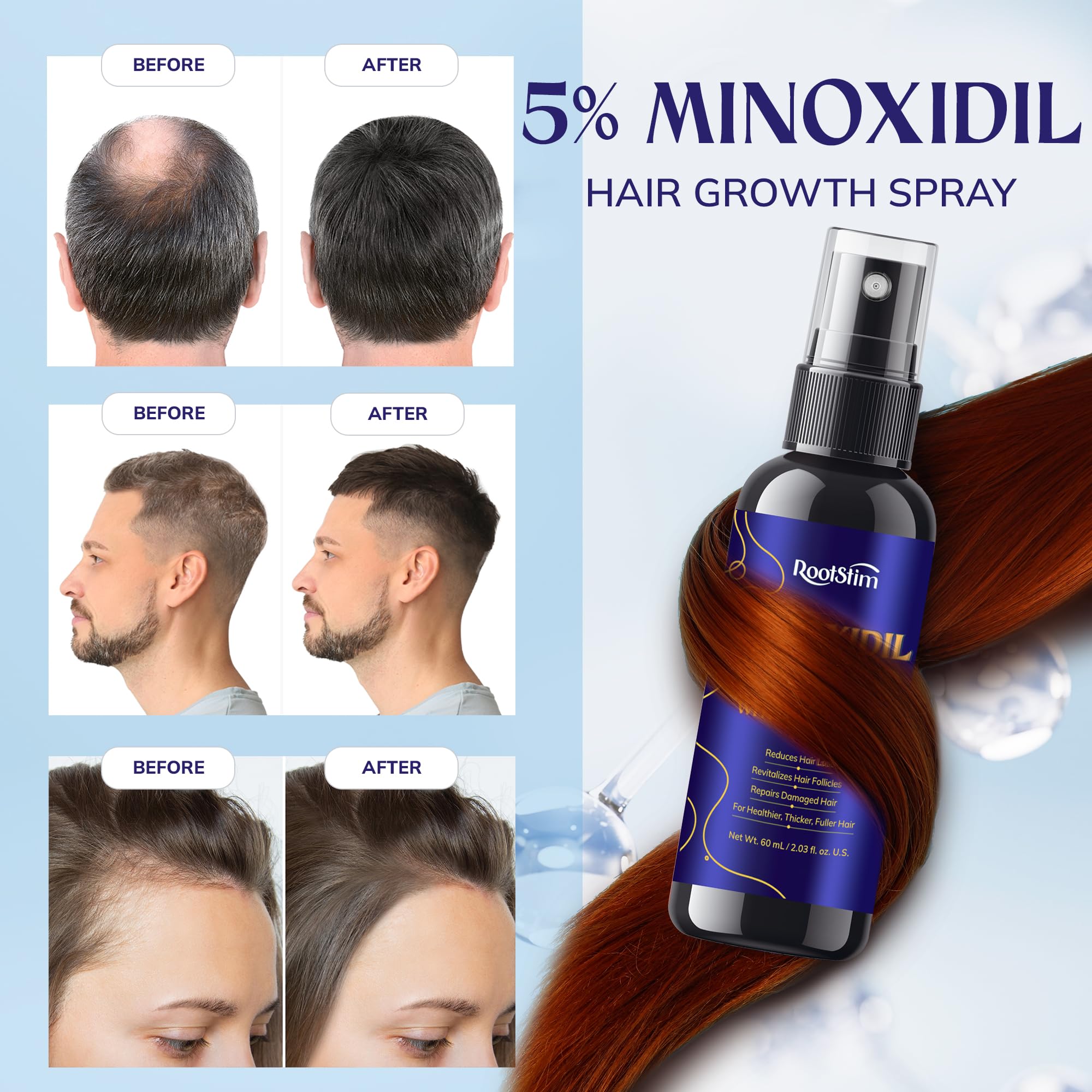 RootStim scalp closeup with thinning areas seeking fuller-looking hair