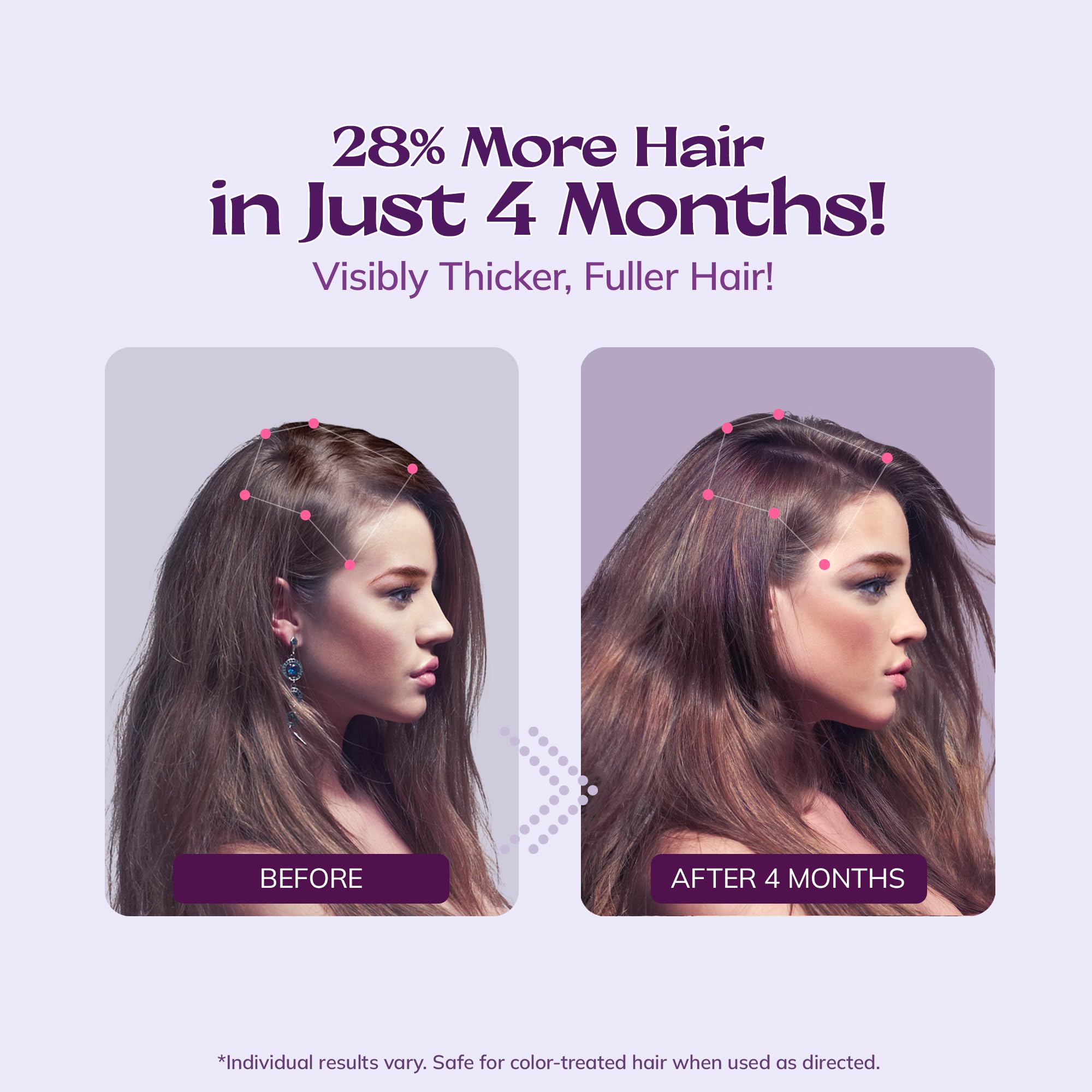 RootStim minoxidil spray application on scalp targeting thinning areas.