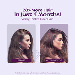 RootStim minoxidil spray application on scalp targeting thinning areas.