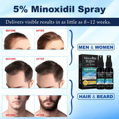 Rosever Minoxidil spray evening application targeting thinning areas.