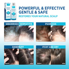 Roycederm Conditioner tube applied to hair for hydration and smoothness