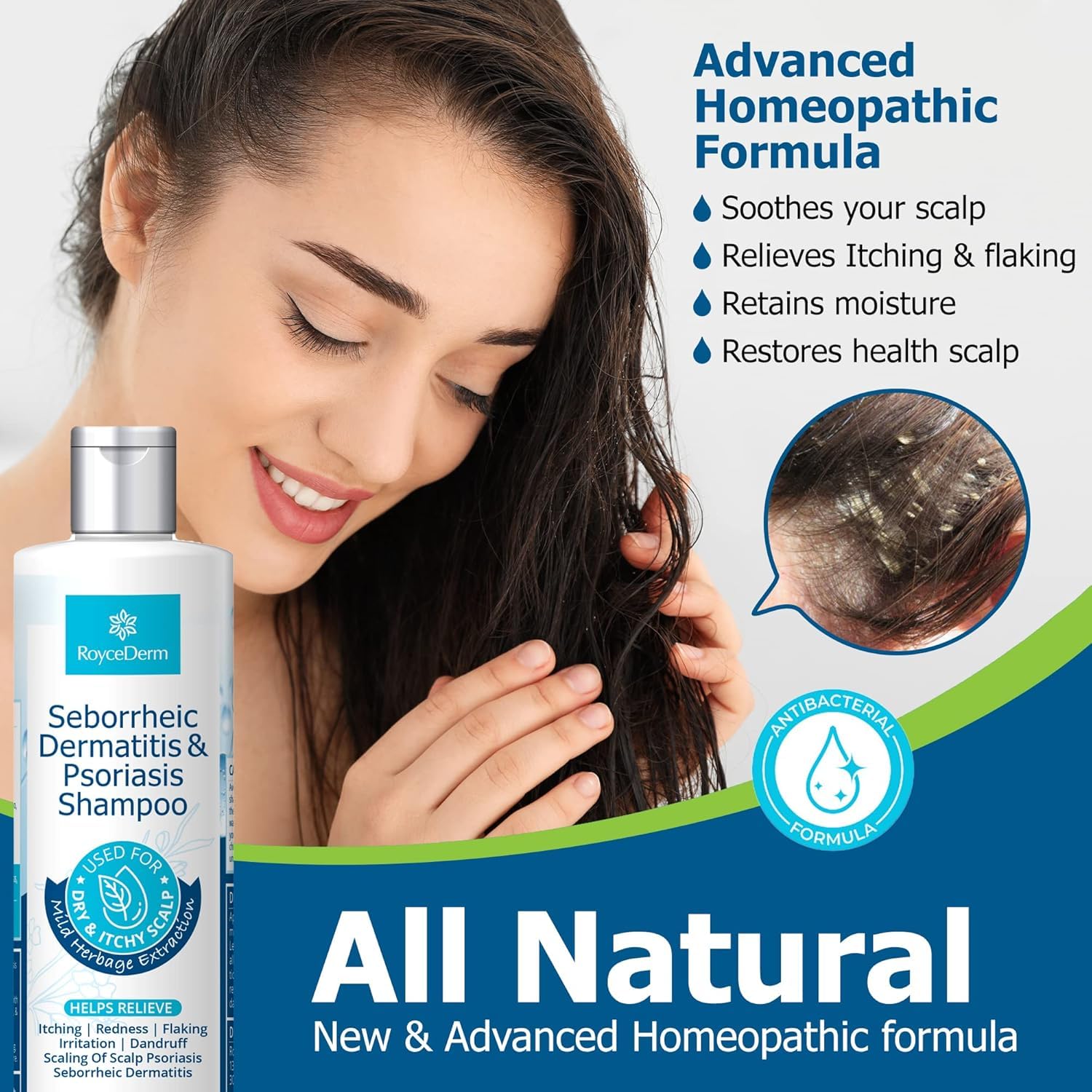 Roycederm Seborrheic Dermatitis Shampoo bottle closeup for soothing scalp care