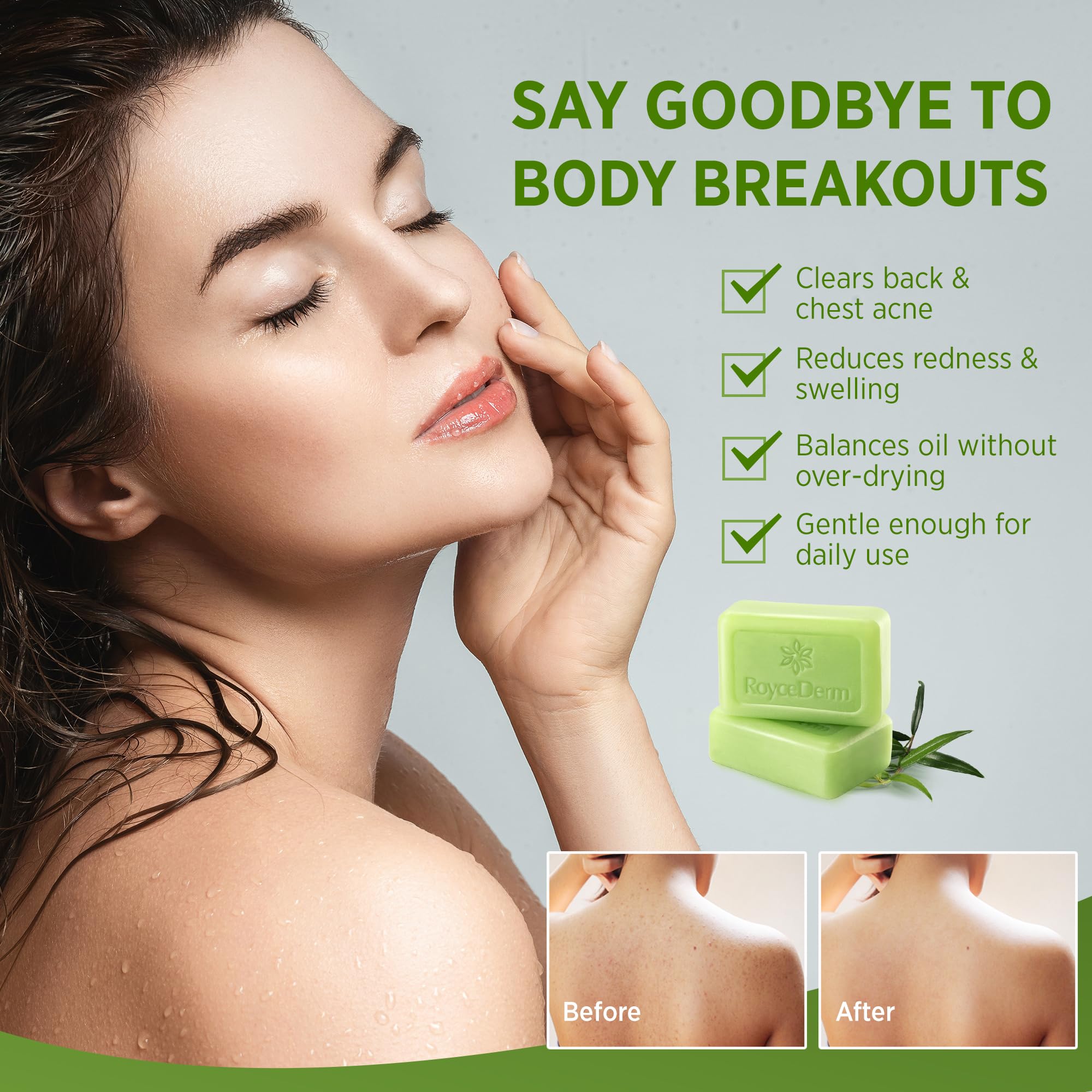 Roycederm Tea Tree Soap pack2 back-label shows ingredients and usage for everyday cleansing.