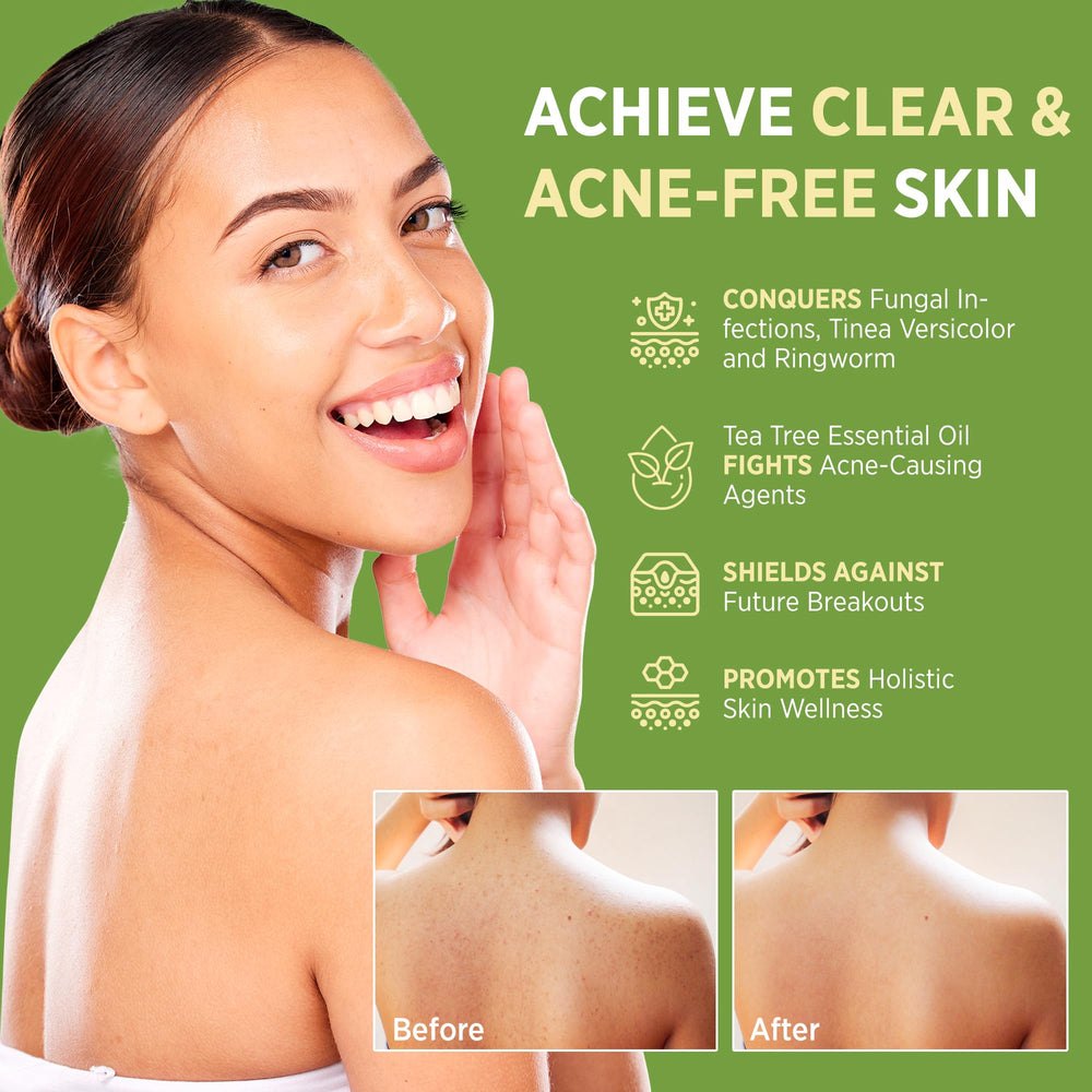 Roycederm tea tree soap packaging shot showing brand and formula