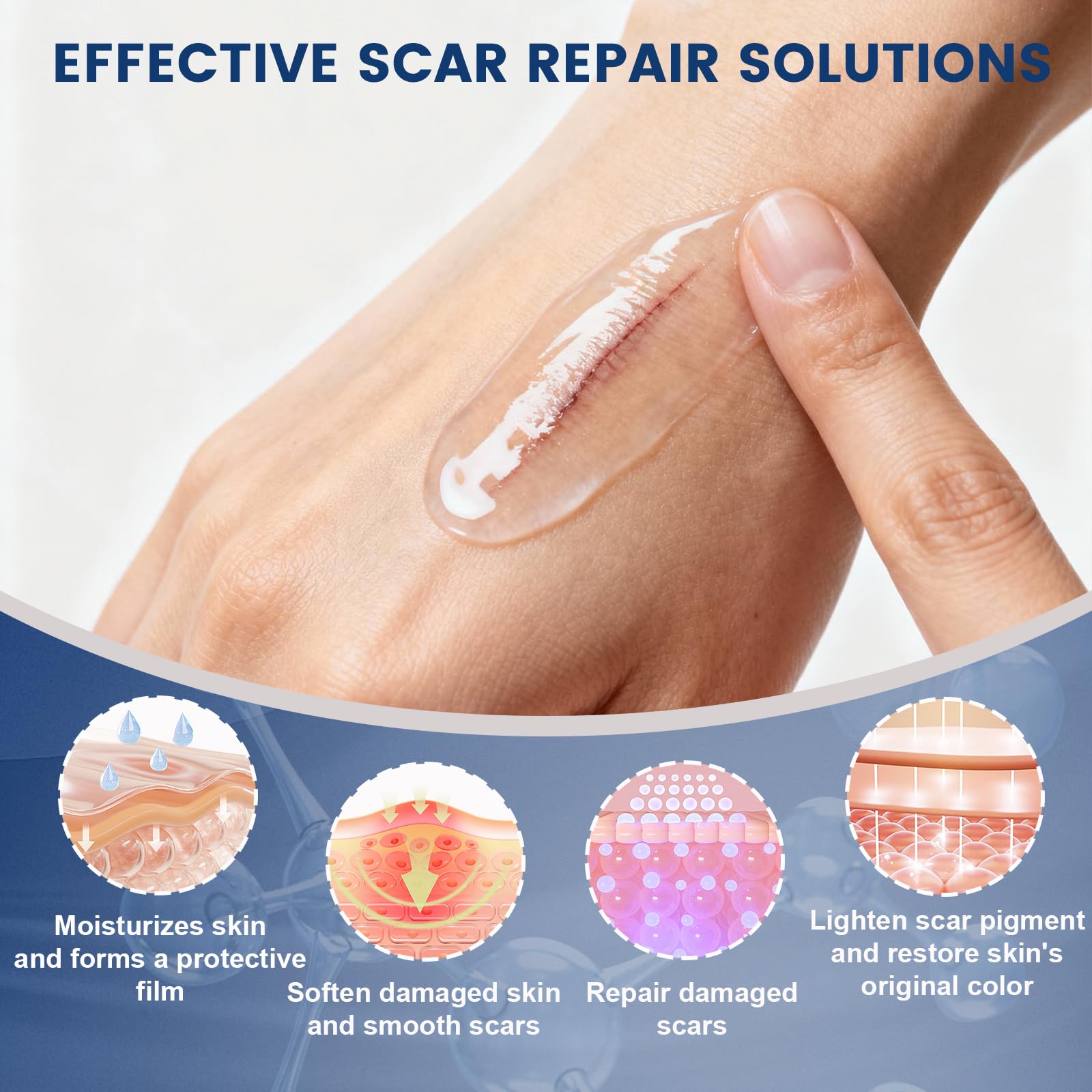 Rvlaim scar gel on softened skin closeup highlights moisturized texture.