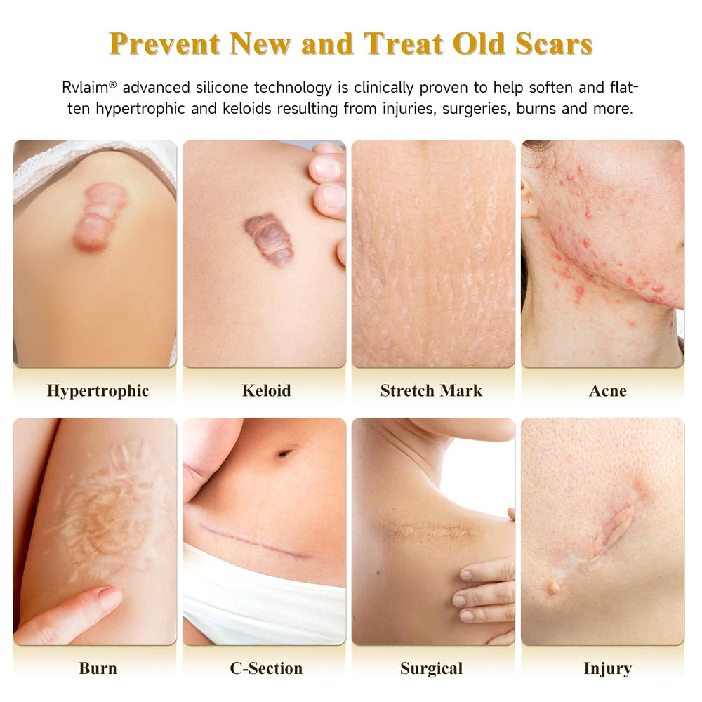 Rvlaim silicone scar cream application closeup shows gentle massage for smoother texture.
