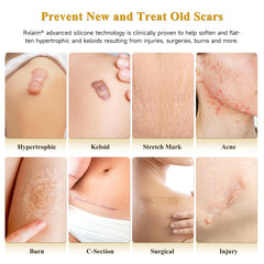 Rvlaim silicone scar cream application closeup shows gentle massage for smoother texture.