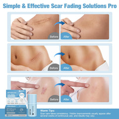 Rvlaim silicone scar stick closeup shows even skin-like barrier during use