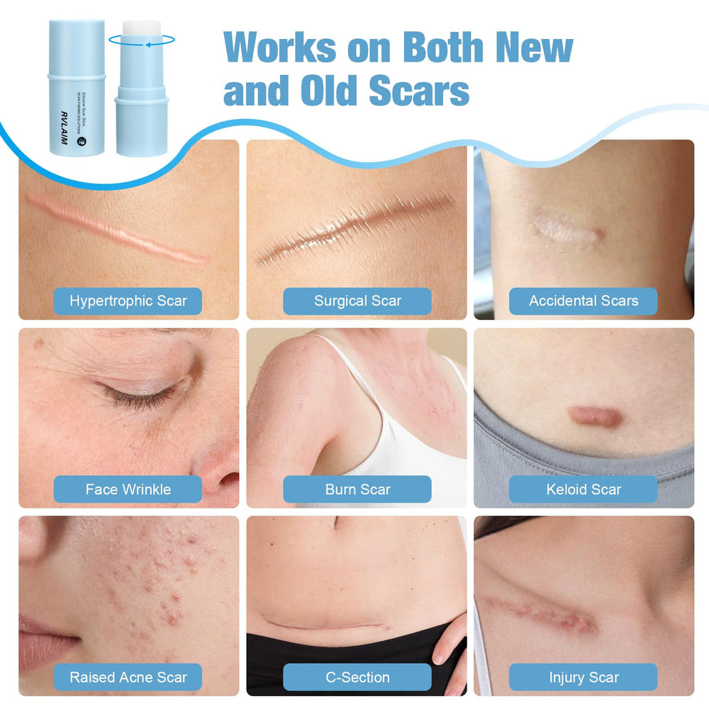 Rvlaim silicone scar stick compact leakproof case enables on-the-go reapplication